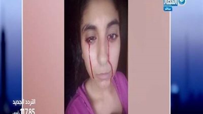 شاهد.. القصة الكاملة لفتاة يخرج الدم من عينها وفمها وأنفها