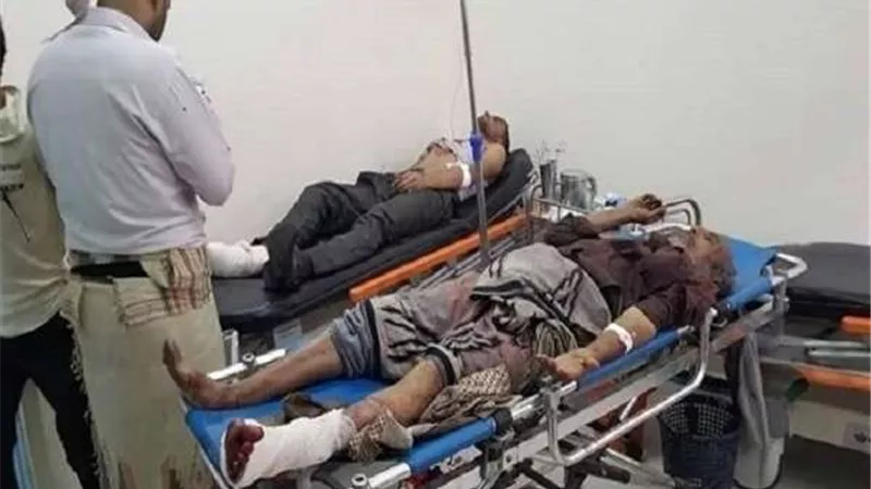 مقتل وإصابة مدنيين في انفجار عبوة ناسفة باليمن