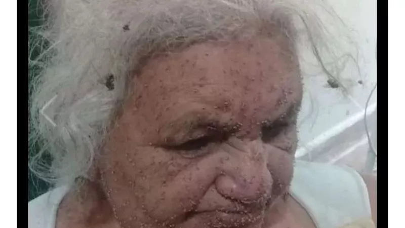 شاهد.. ماذا حدث لمسنة تعرضت لآلاف اللدغات من سرب نحل ضخم؟