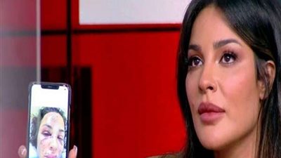 بعد انفجار بيروت.. فنانة تصدم جمهورها بإطلالة مشوهة
