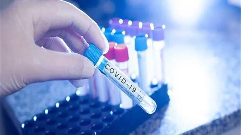 أستاذ بجامعة عين شمس يكشف تفاصيل هامة بشأن لقاح كورونا