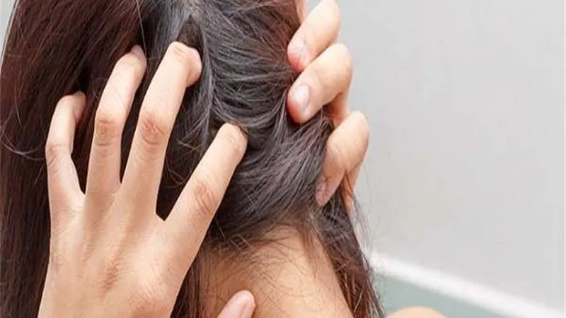 في ثلاثة أيام.. وصفة سحرية لمنع تساقط الشعر