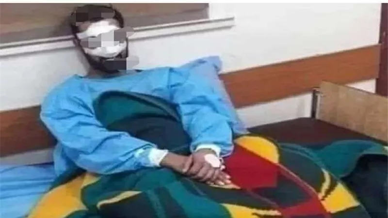 قطعت أنفه.. سيدة تنتقم من زوجها لهذا السبب