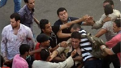 ضبط عاطل مزق وجه شاب بسلاح كاتر في المحلة