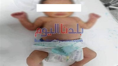 قلب ميت يلقي بطفل 