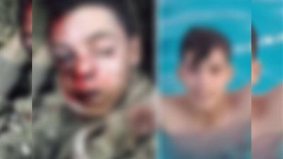 مجهولون يشرعون في مقتل طفل والقائة بالزراعات بأسيوط