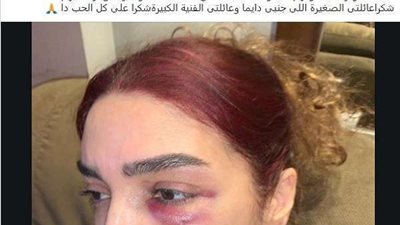 روچينا تقدم الشكر الجمهورية..  لهذا السبب