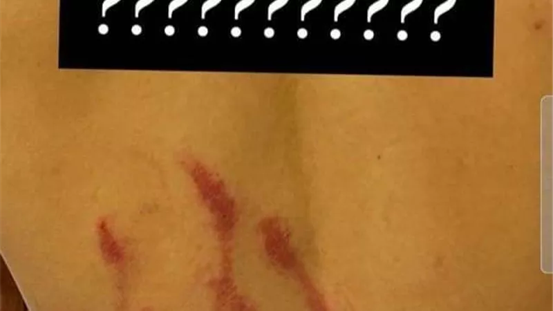 محمد شريف يكشف حجم إصابته بعد تدخل حارس صن داونز