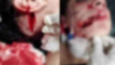 رجل يمزق وجه زوجته بسلاح أبيض بالقليوبية