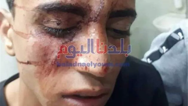 جهود مكثفة لضبط المتهم بأصابة شاب بسبب معاكسة فتاة فى الغربية.. (صورة)