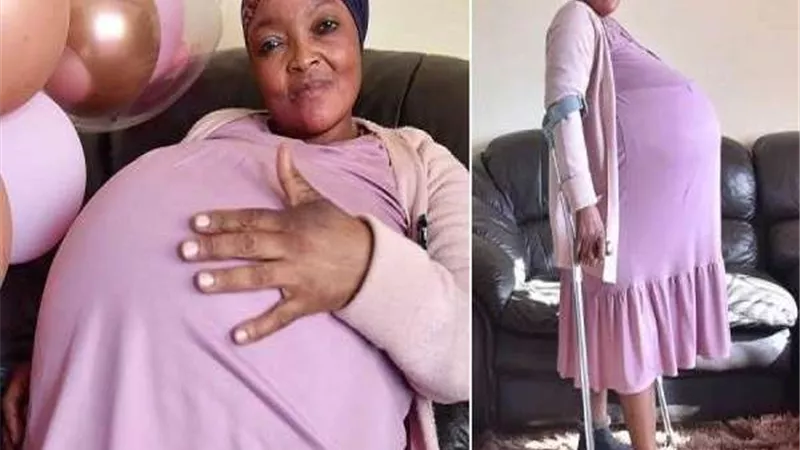 في الأسبوع الـ 29 من الحمل.. سيدة تنجب 10 توائم دفعة واحدة