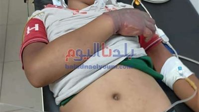 بتر يد طفل بعد تقيده لسرقته بالإكراه في الغربية