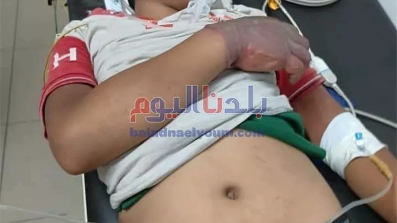 بتر يد طفل بعد تقيده لسرقته بالإكراه في الغربية