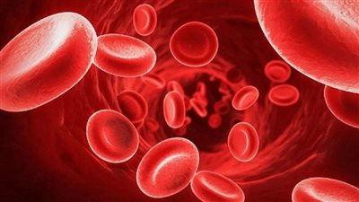 أستاذة طب الأطفال: فقر الدم المنجلي مرض وراثي منتشر في الواحات وسيوة بسبب تزاوج القبائل الأفريقية