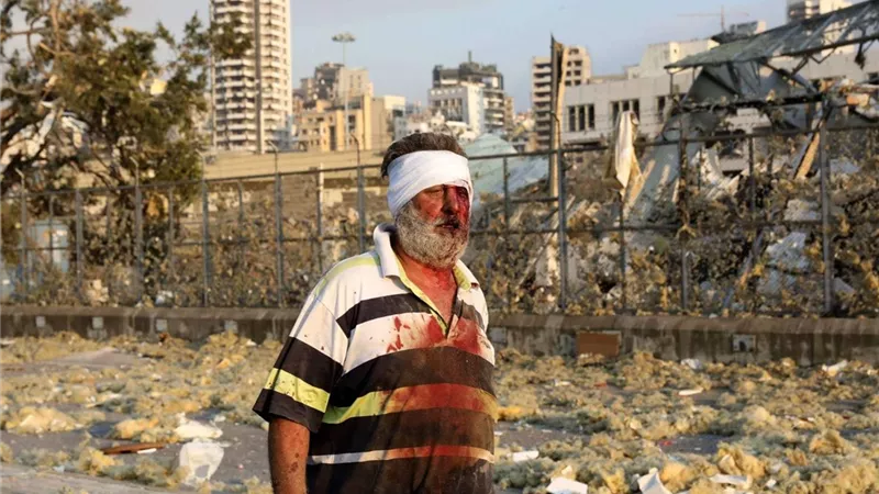 ماذا يحدث في لبنان؟.. تفاصيل انفجار الأجهزة اللاسلكية وسقوط آلاف المصابين والشهداء