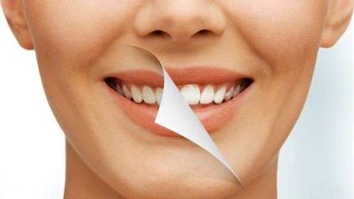طرق فعّالة للتخلص من البقع الصفراء على الأسنان