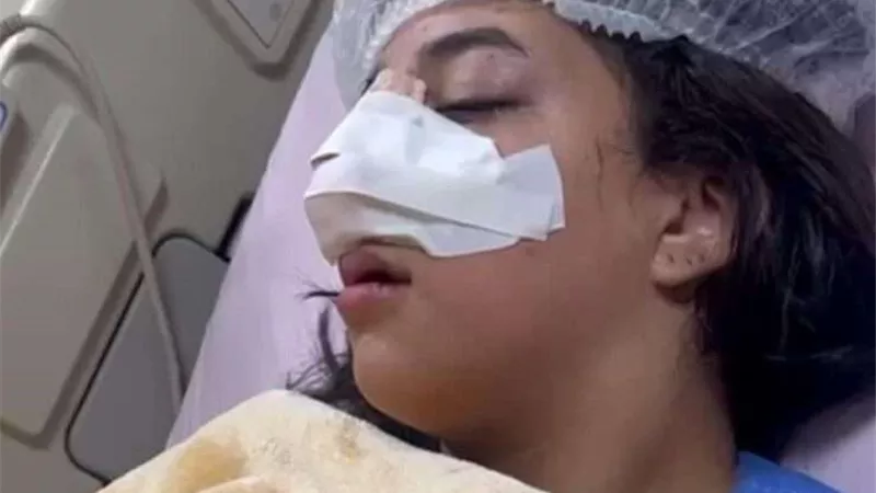 والد طالبة التجمع يكشف تفاصيل جديدة في واقعة كسر أنف إبنته على يد زميلاتها