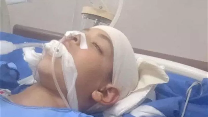 اعتداء ثلاثة شباب على طفل بكفرالشيخ ووالده عايز حق ابنى