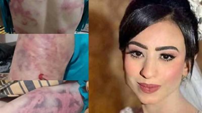 قرار عاجل ضد الزوج المتهم بتعذيب زوجته مهرائيل صبري عروس بني سويف