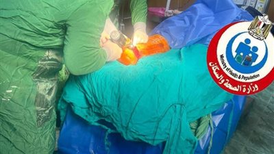 بطولة بيضاء في قويسنا.. مستشفى مركزي ينقذ قدم شابة من البتر بعد حادث قطار .. صور 