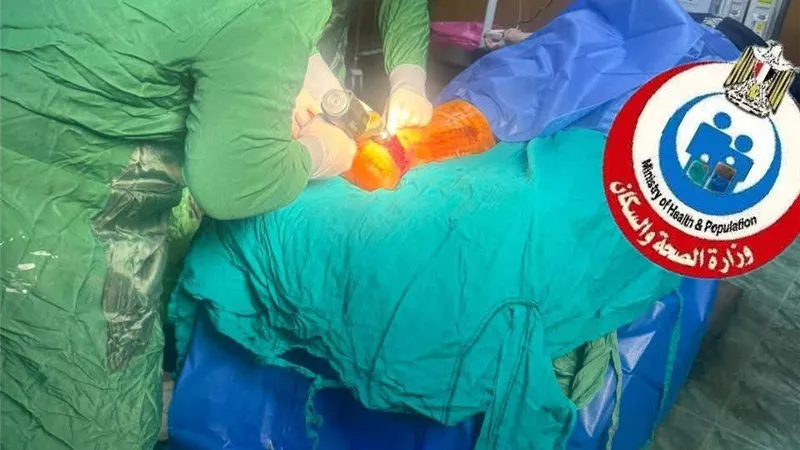 بطولة بيضاء في قويسنا.. مستشفى مركزي ينقذ قدم شابة من البتر بعد حادث قطار .. صور 