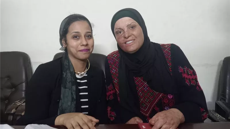 عاقبت إسرائيل واحترقت لفلسطين.. «بلدنا اليوم» تحاور الأسيرة المحررة إسراء جعابيص