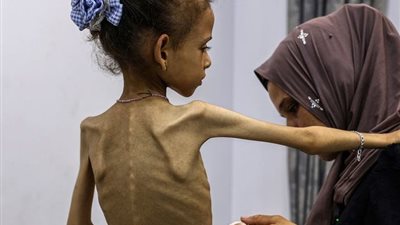 مفوض الأونروا: المجاعة في غزة ليست ظاهرة طبيعية، بل نتيجة قيود الاحتلال