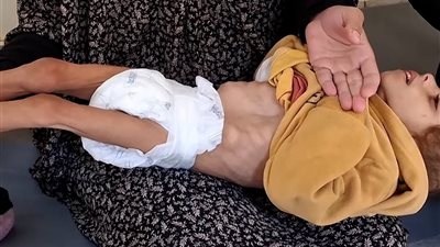 الأمم المتحدة: هجوم الاحتلال الإسرائيلي المتواصل يفاقم أزمة سوء التغذية في غزة