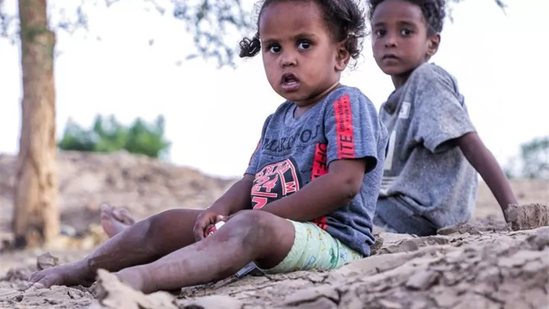 كارثة إنسانية في السودان بجنوب كردفان.. موت 23 طفل ضحية للجوع والمرض