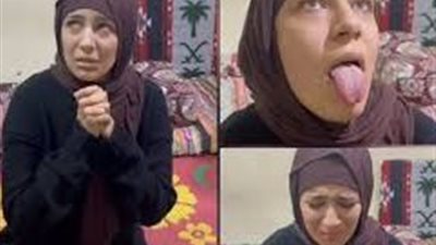 يوم فرحها.. فتاة البشعة تروي قصة تعامل الجيران معها قبل وبعد البشعة