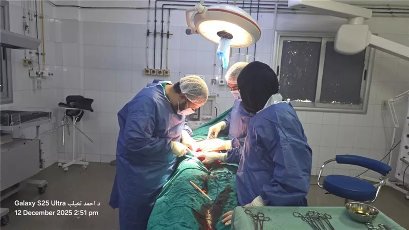  76عملية في يوم واحد .. إنجاز طبي جديد بمستشفى أشمون العام بالمنوفية