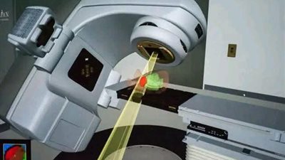إضافة تقنية العلاج الإشعاعي متعدد الشدة (IMRT) بمركز القوات المسلحة للأورام بالإسماعيلية
