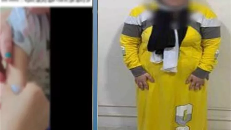 عقاب مؤلم.. أم تحرق وجه ابنتها بسبب زيارة منزل طليقها