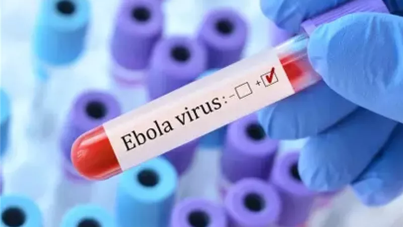 بسبب طبيب فرنسي.. تحركات دولية لمحاصرة إيبولا بعد تسجيل إصابة في باريس