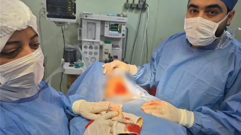 صحة الدقهلية: نجاح استئصال تضخم بالغدة الدرقية ممتد للتجويف الصدري بالجمالية المركزي