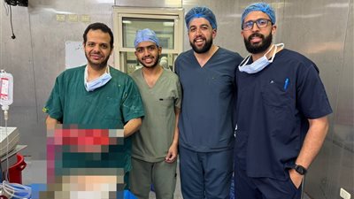 فريق طبي بالقصر العيني ينجح في استئصال ورم نادر لمريض يبلغ 65 عامًا