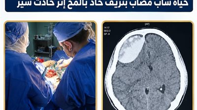 نجاح جراحة مخ وأعصاب دقيقة تنقذ حياة شاب بعد نزيف حاد إثر حادث سير