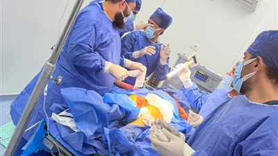 صحة الدقهلية تنجح في أول عملية ترقيع جلدي متطورة لطفل بحروق تجاوزت 30%