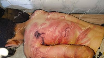 طفل في مواجهة القسوة.. كيف تحركت العدالة في واقعة عزبة الرمل بالمنوفية؟ 