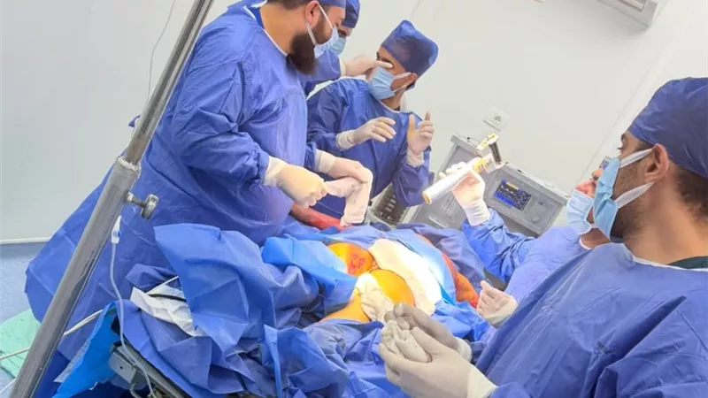 صحة الدقهلية تنجح في أول عملية ترقيع جلدي متطورة لطفل بحروق تجاوزت 30%