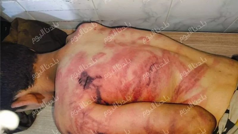 طفل في مواجهة القسوة.. كيف تحركت العدالة في واقعة عزبة الرمل بالمنوفية؟ 